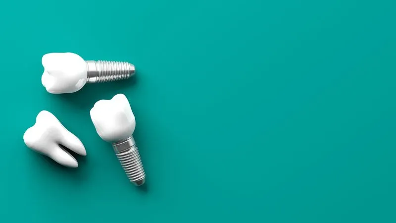 Dental implant posts and a natural tooth shown side by side