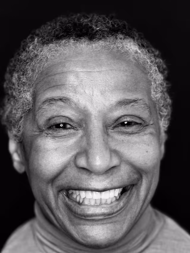 Jan after treatment at White32 Dental, Implant-Retained Upper Denture