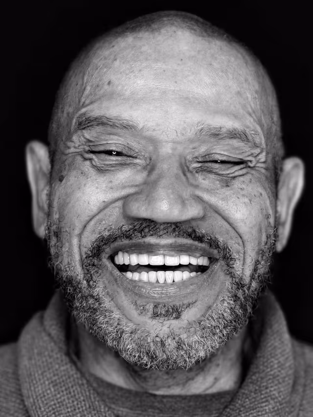 John after treatment at White32 Dental, Implants, Crowns & Veneers