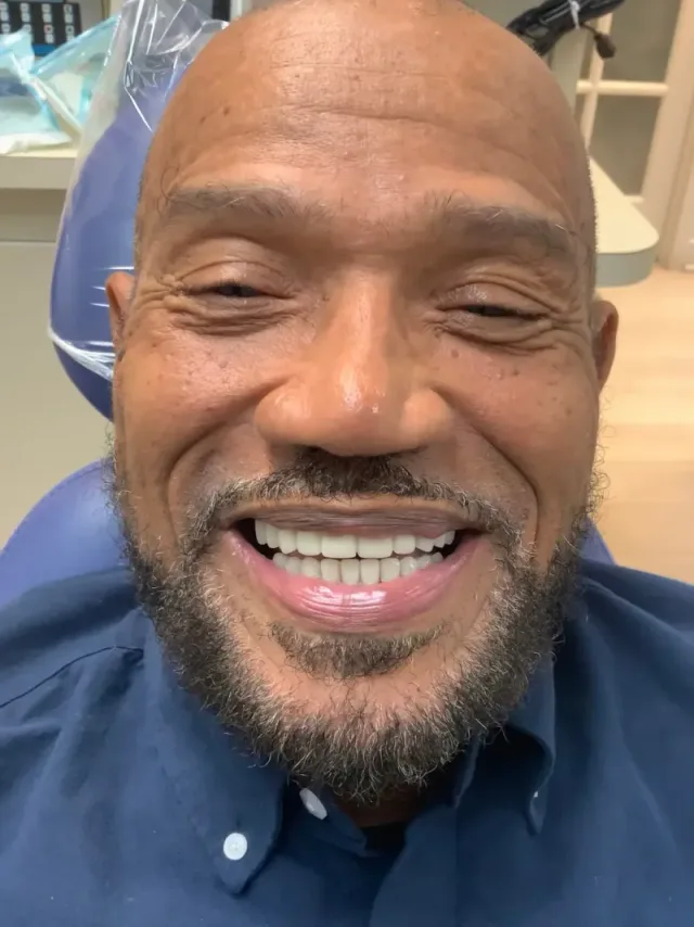 John after Implants, Crowns & Veneers at White32 Dental