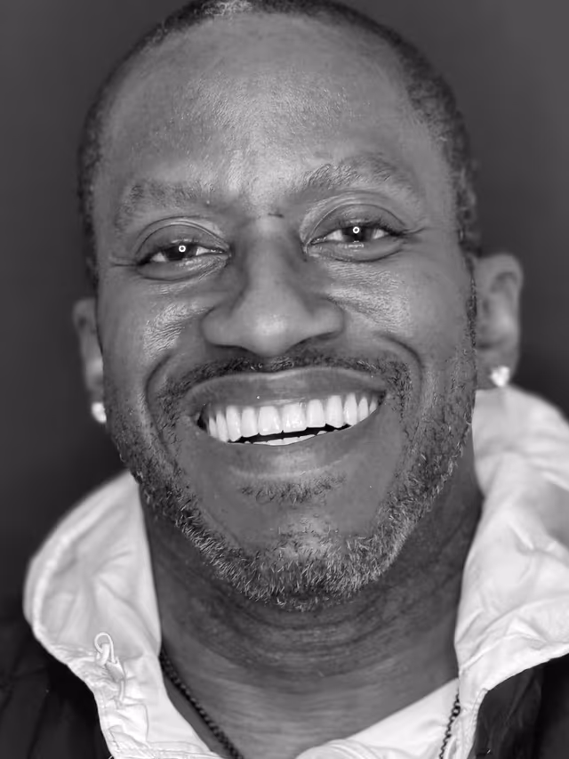 Tristan after treatment at White32 Dental, Upper & Lower Dentures